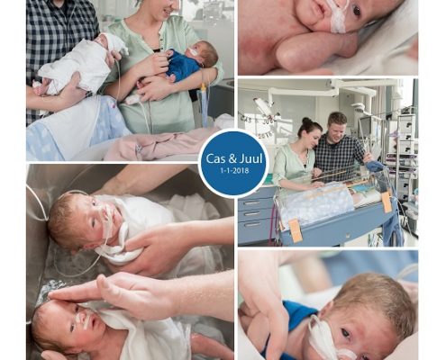 Cas & Juul prematuur geboren met 26 weken en 5 dagen, tweeling, UZA