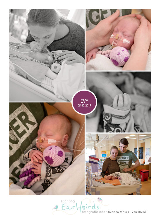 Evy prematuur geboren met 25 weken en 5 dagen, Radboud MC, zwangerschapsvergiftiging, keizersnede, CPAP 7, HELLP syndroom, longontsteking