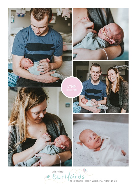 Lynn prematuur geboren met 30 weken