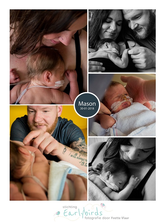 Mason prematuur geboren met 35 weken, MCA, spoedkeizersnede, neonatologie