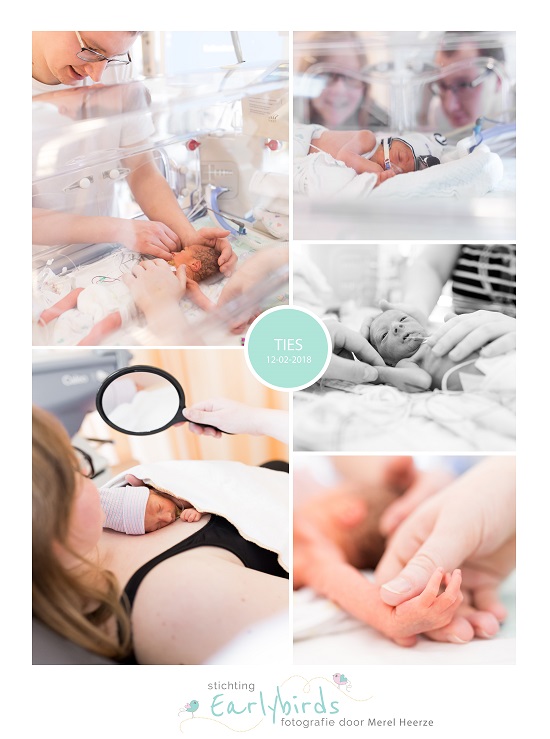 Ties prematuur geboren met 31 weken, Radboud ziekenhuis, spoedkeizersnede, CPAP
