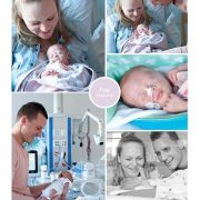 Fiep prematuur geboren met 33 weken en 5 dagen, dismatuur, spoedkeizersnede, syndroom van Down, Zaans Medisch Centrum