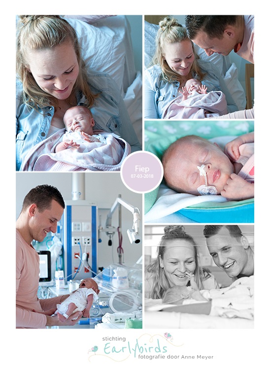 Fiep prematuur geboren met 33 weken en 5 dagen, dismatuur, spoedkeizersnede, syndroom van Down, Zaans Medisch Centrum