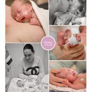 Yasmin prematuur geboren met 26 weken en 5 dagen, Radboud UMC, keizersnede, neonatologie, couveuse, buidelen