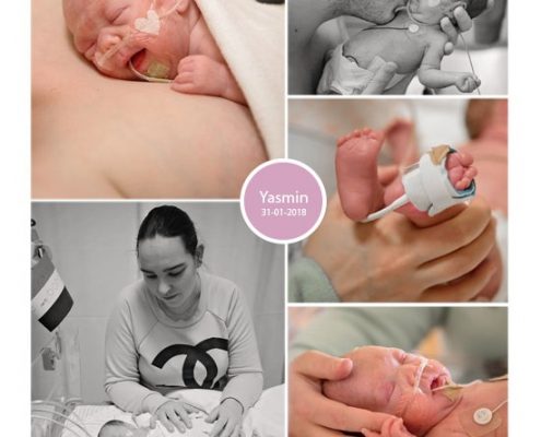 Yasmin prematuur geboren met 26 weken en 5 dagen, Radboud UMC, keizersnede, neonatologie, couveuse, buidelen