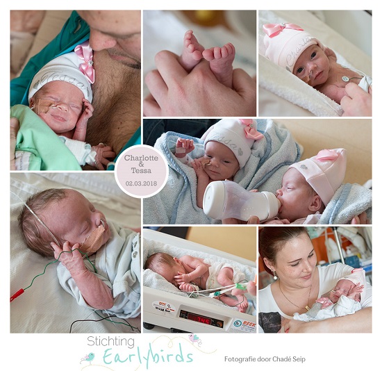 Charlotte & Tessa prematuur geboren met 34 weken en 5 dagen, tweeling, zwangerschapsvergiftiging, couveuse