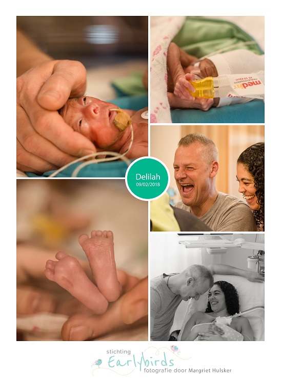 Delilah prematuur geboren met 24 weken en 3 dagen, LUMC, keizersnede, placenta