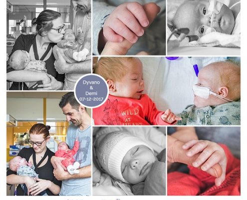 Demi & Dyvano prematuur geboren met 31 weken, tweeling, Sydroom van Down, flesvoeding