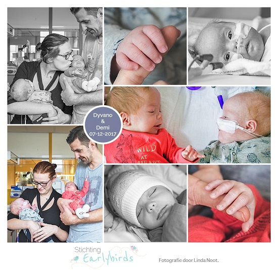 Demi & Dyvano prematuur geboren met 31 weken, tweeling, Sydroom van Down, flesvoeding