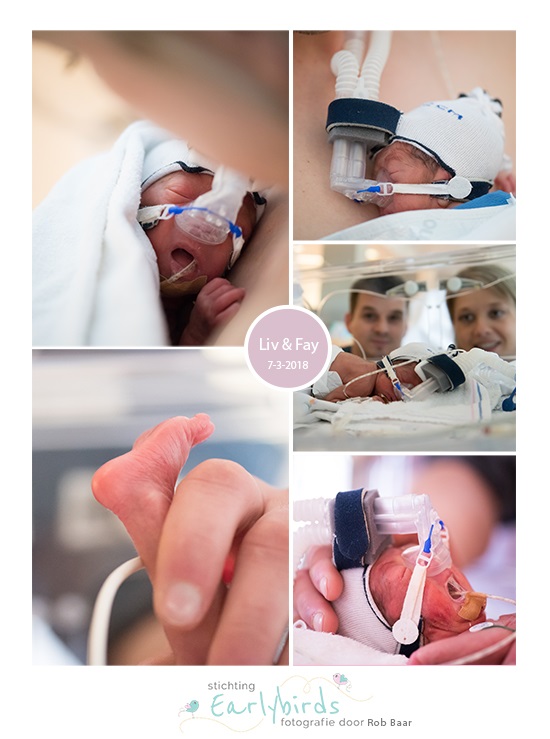 Fay & Liv prematuur geboren met 25 weken en 5 dagen, tweeling, Radboud MC, couveuse