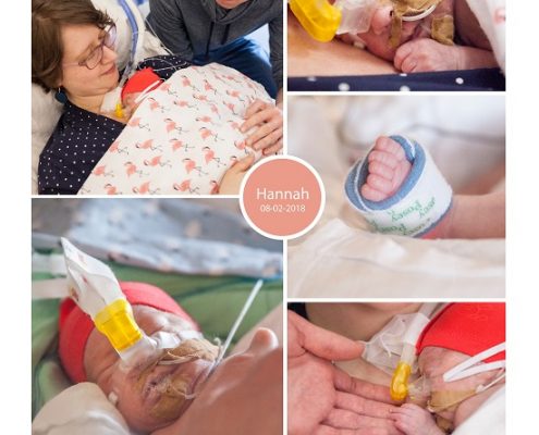 Hannah prematuur geboren met 27 weken en 3 dagen, zwangerschapsvergiftiging, LUMC, spoedkeizersnede, longrijping, couveuse, CPAP, NICU