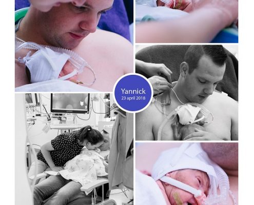 Yannick prematuur geboren met 25 weken en 1 da, UMCG, buidelen, couveuse, CPAP, sonde