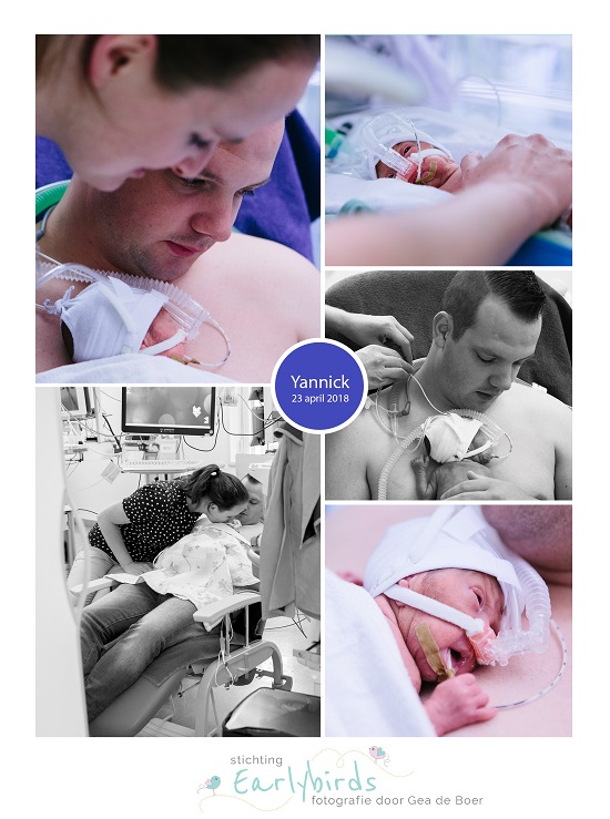 Yannick prematuur geboren met 25 weken en 1 da, UMCG, buidelen, couveuse, CPAP, sonde