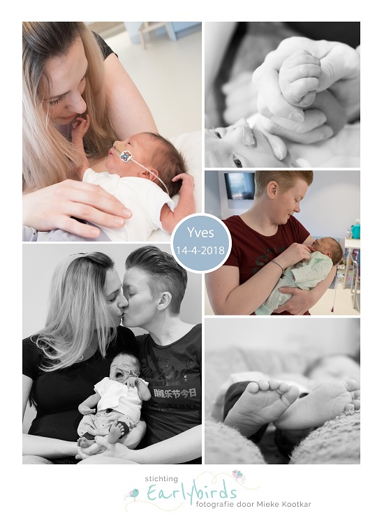 Yves prematuur geboren met 31 weken en 6 dagen. Elkerliek ziekenhuis, Radboud, bedrust, couveuse, sondevoeding