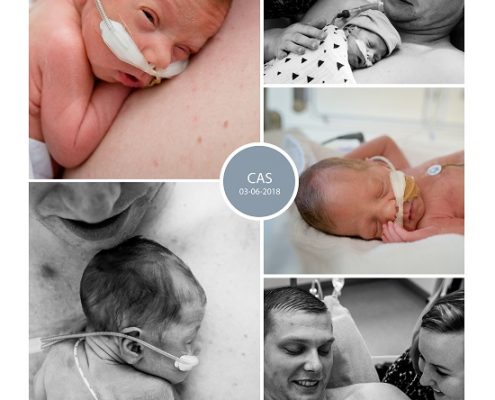 Cas prematuur geboren met 29 weken en 2 dagen, longrijping, UMCG, gebroken vliezen