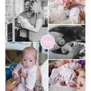 Chelsea prematuur geboren met 36 weken, gastroschisis, Sophia Kinder ziekenhuis