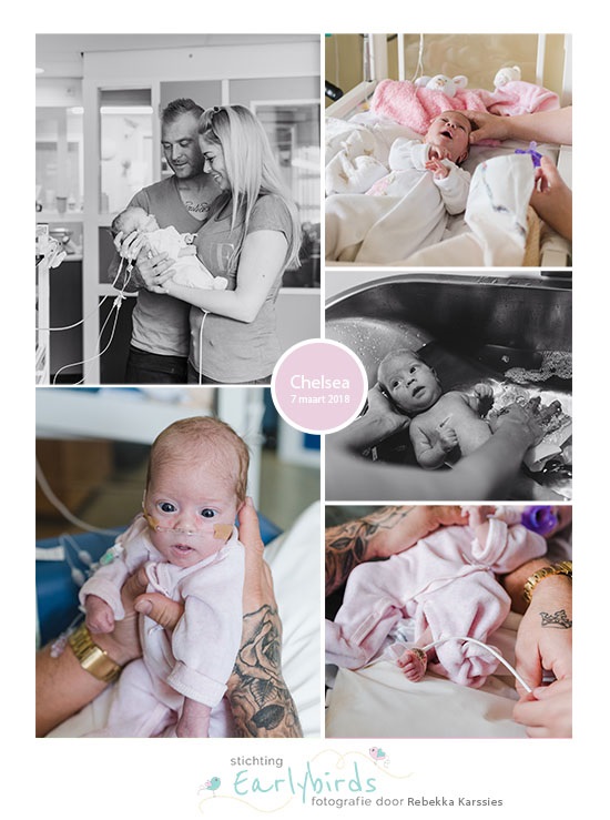 Chelsea prematuur geboren met 36 weken, gastroschisis, Sophia Kinder ziekenhuis