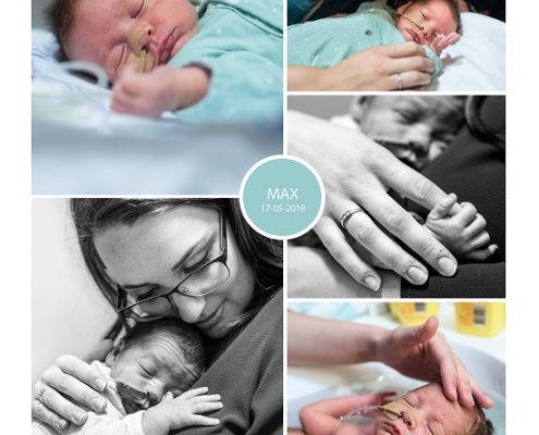 Max prematuur geboren met 33 weken en 5 dagen, Bravis ziekenhuis, ontsluiting, sondevoeding