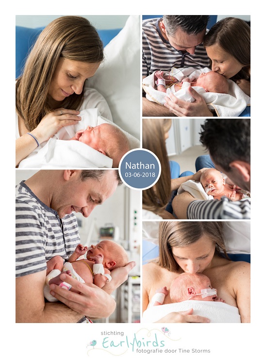 Nathan prematuur geboren met 35 weken, GZA Sint. Vincentiusziekenhuis, sondevoeding, buidelen, vroeggeboorte