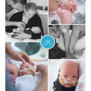 Sem prematuur geboren met 28 weken en 3 dagen, keizersnede, CPAP, UMCG