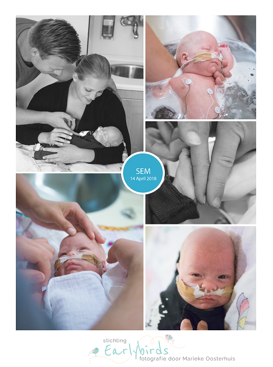 Sem prematuur geboren met 28 weken en 3 dagen, keizersnede, CPAP, UMCG