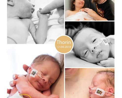 Thorin prematuur geboren met 31+ weken, gebroken vliezen, weeenremmers, keizersnede, stuitligging