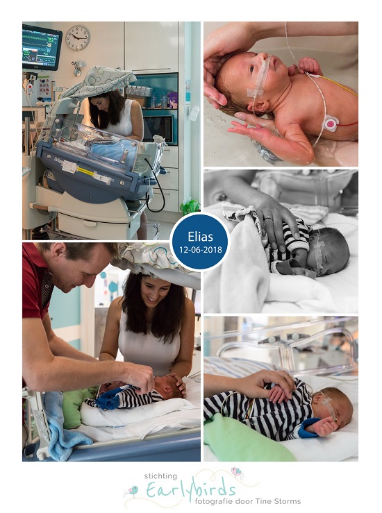 Elias prematuur geboren met 30 weken en 1 dag, UZ Leuven, vroeggeboorte, sondevoeding