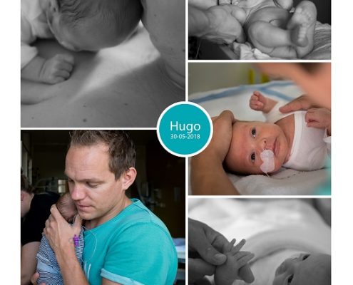 Hugo prematuur geboren met 31 weken en 2 dagen, vroeggeboorte, Westfries Gasthuis Hoorn, sondevoeding