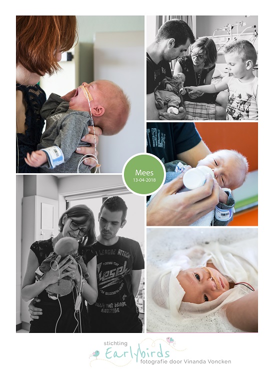 Mees prematuur geboren met 31 weken en 4 dagen, Zuyderland Heerlen, vroeggeboorte, sondevoeding