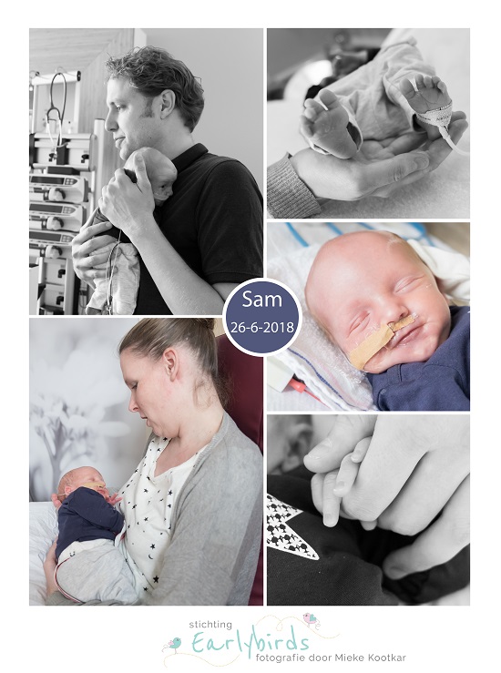 Sam prematuur geboren met 33 weken, VieCuri Venlo, vroeggeboorte, sonde