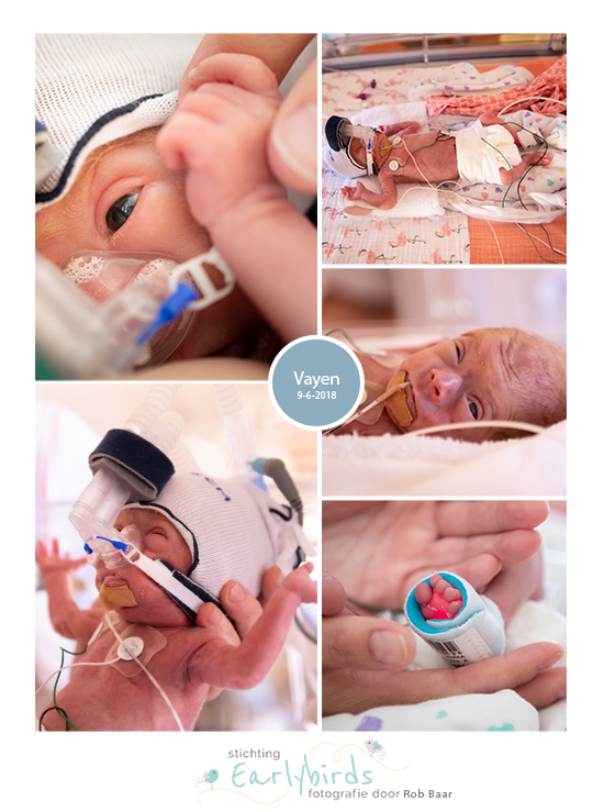 Vayen prematuur geboren met 29 weken en 1 dag, Radboud, vroeggeboorte, CPAP, sondevoeding