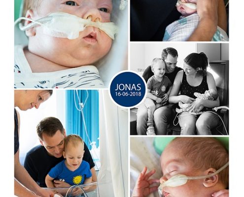 Jonas prematuur geboren met 27 weken en 2 dagen, OLVG Oost, gebroken vliezen, vroeggeboorte, sondevoeding