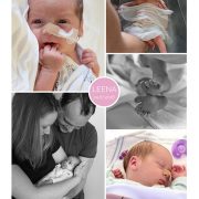 Leena prematuur geboren met 33 weken, WKZ, spoedkeizersnede, placenta abruptio, longrijping, couveuse, Diakonessenhuis