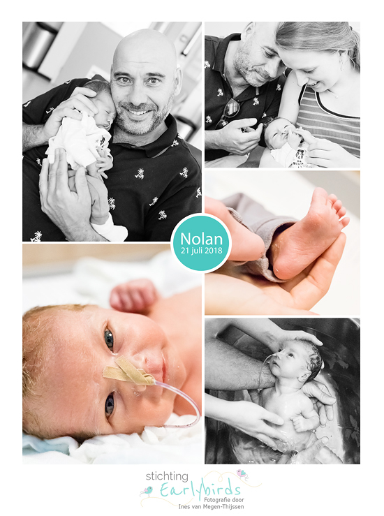 Nolan prematuur geboren met 33 weken en 2 dagen, SJG Weert, sonde, vroeggeboorte