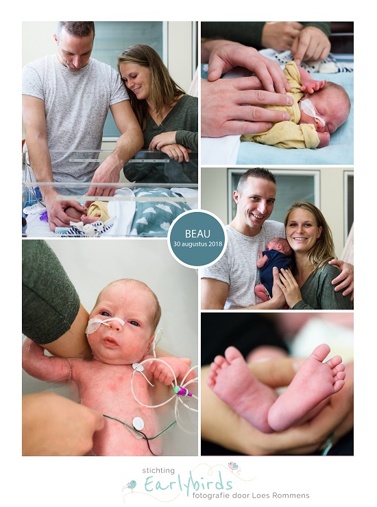 Beau prematuur geboren met 30 weken en 5 dagen, borstvoeding, Amphia Breda, sondevoeding, vroeggeboorte