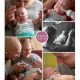 Charlotte prematuur geboren met 24 weken en 1 dag, sondevoeding, tweeling, vlinderkindje, MMC Veldhoven, vroeggeboorte