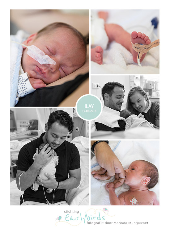 Ilay prematuur geboren met 31 weken en 5 dagen, tweeling, Westfriesgasthuis Hoorn, sondevoeding