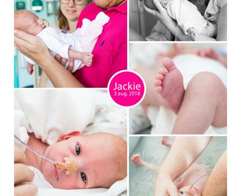 Jackie prematuur geboren met 31 weken en 4 dagen, SJG Weert, tweeling, gebroken vliezen, borstvoeding, sonde