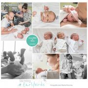 Liva, Mike & Timo prematuur geboren met 33 weken en 3 dagen, drieling, zwangerschapsvergiftiging, LUMC, JKZ, UMCG, Alrijne, buidelen, sonde