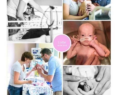 Lotte prematuur geboren met 35 weken, UZ Gent, neonatologie, HELLP syndroom, keizersnede, sonde