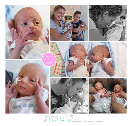 Madison & Allison prematuur geboren met 32 weken en 5 dagen, tweeling, sondevoeding, St. Antonius ziekenhuis Nieuwegein