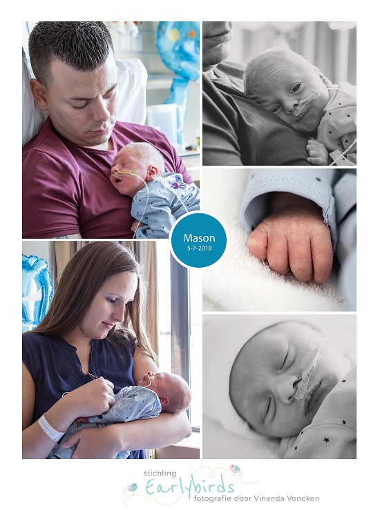 Mason prematuur geboren met 34 weken, Zuijderland Medisch Centrum Heerlen, vroeggeboorte, earlybirdje, sondevoeding