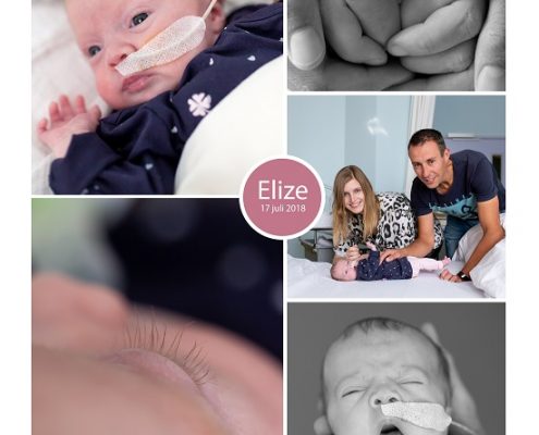 Elize prematuur geboren met 33 weken, spoedkeizersnede, sondevoeding, earlybirdje