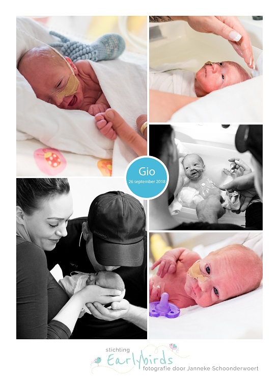 Gio prematuur geboren met 33 weken en 5 dagen, MKC Bergen op Zoom, zwangerschapsvergiftiging, couveuse, spoedkeizersnede, sonde