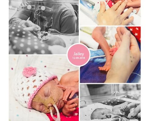 Jailey prematuur geboren met 27 weken en 5 dagen, Erasmus MC, sondevoeding, vroeggeboorte