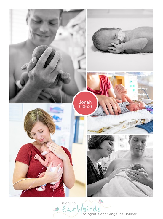 Jonah prematuur geboren met 31 weken, Gelderse Vallei Ede, bloedverlies, RadboudMC, spoedkeizersnede, CPAP, Ronald McDonaldhuis, couveuse, borstvoeding, buidelen