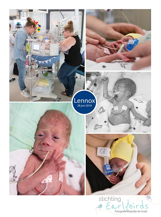 Lennox prematuur geboren met 26 weken, zwangerschapsdiabetes, HELLP syndroom, WKZ, NICU, sonde