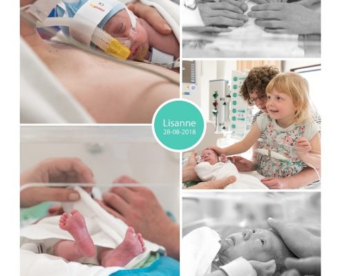 Lisanne prematuur geboren met 27 weken, LUMC, neonatologie, couveuse, spoedkeizersnede, Reinier de Graaf, CPAP