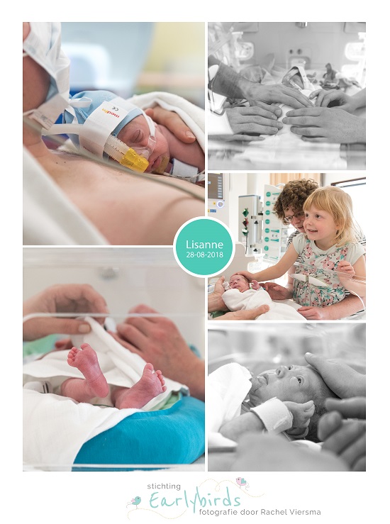 Lisanne prematuur geboren met 27 weken, LUMC, neonatologie, couveuse, spoedkeizersnede, Reinier de Graaf, CPAP
