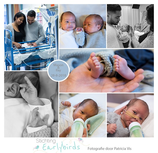 Mason & Ilay prematuur geboren met 33 weken, tweeling, Rienier de Graaf, weeenremmers, longrijping, open ductus